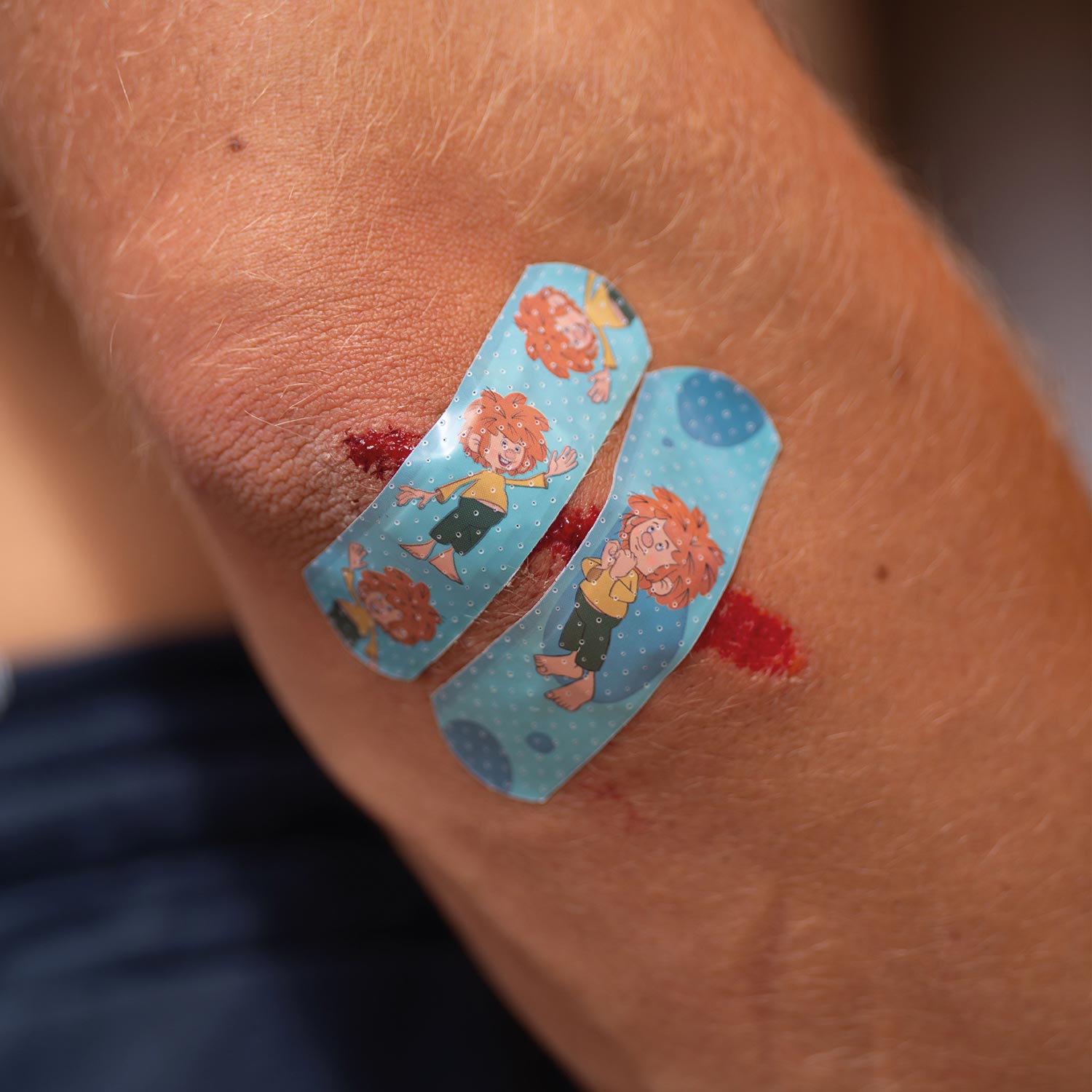 Zwei Pumuckl Trost-Pflaster auf einem Kinderarm, die kleine Schürfwunden mit Comic-Motiven bedecken.